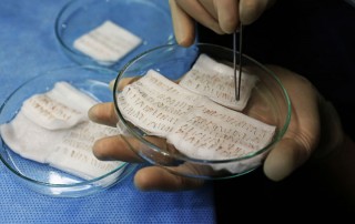 3000 kök saç ekimi