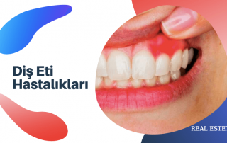 Diş Eti Hastalığı (Periodontoloji) Nedir?
