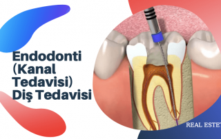 Endodonti (Kanal Tedavisi) Diş Tedavisi 