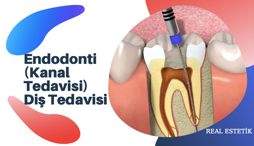 Endodonti (Kanal Tedavisi) Diş Tedavisi 