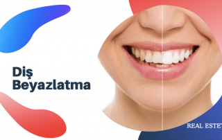 diş beyazlatma hakkında