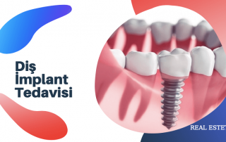 diş implant tedavisi