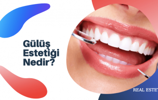 gulus estetigi nedir?