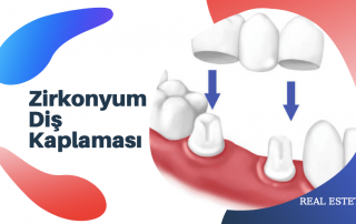 zirkonyum diş kaplaması